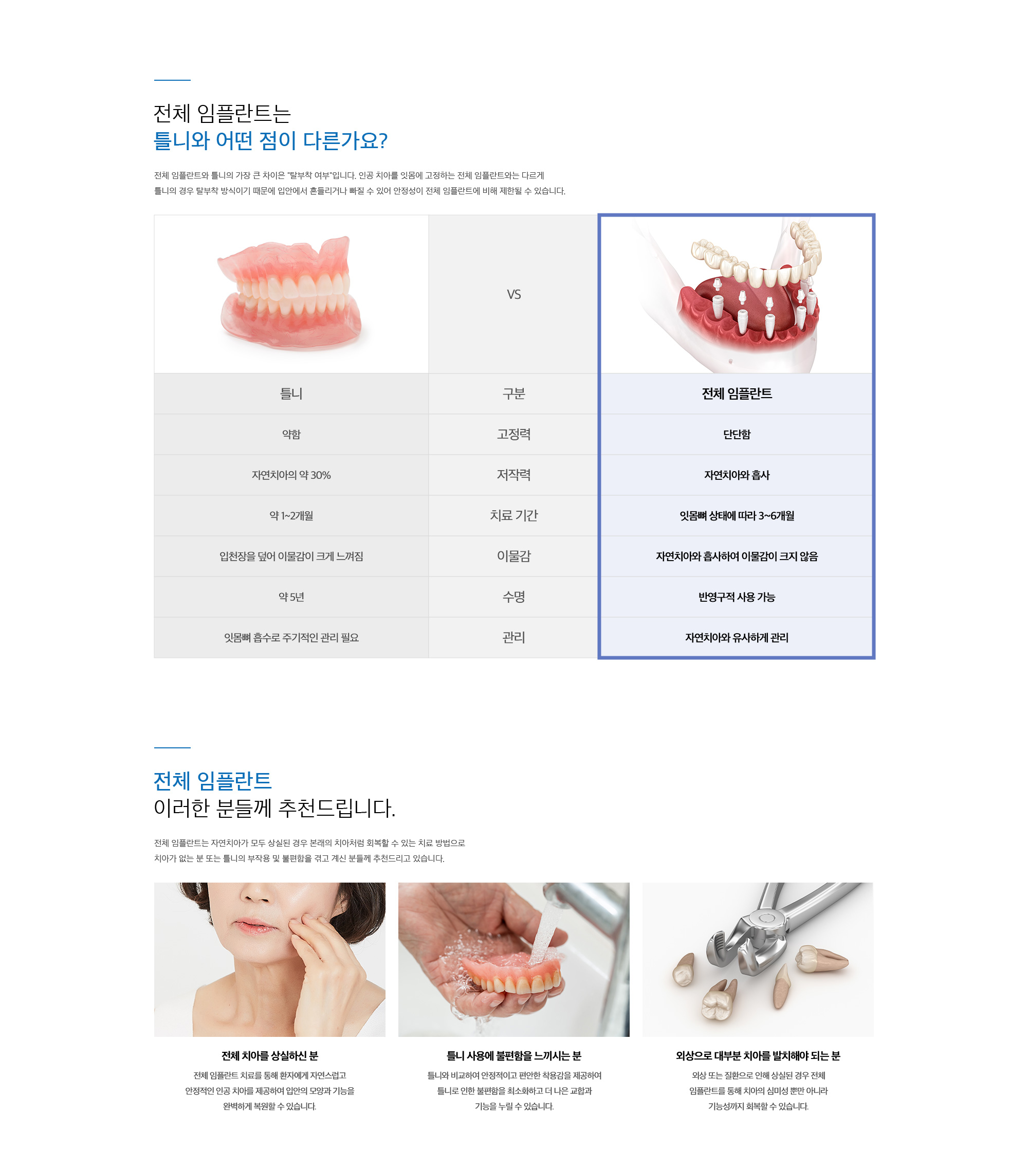전체(무치악) 임플란트