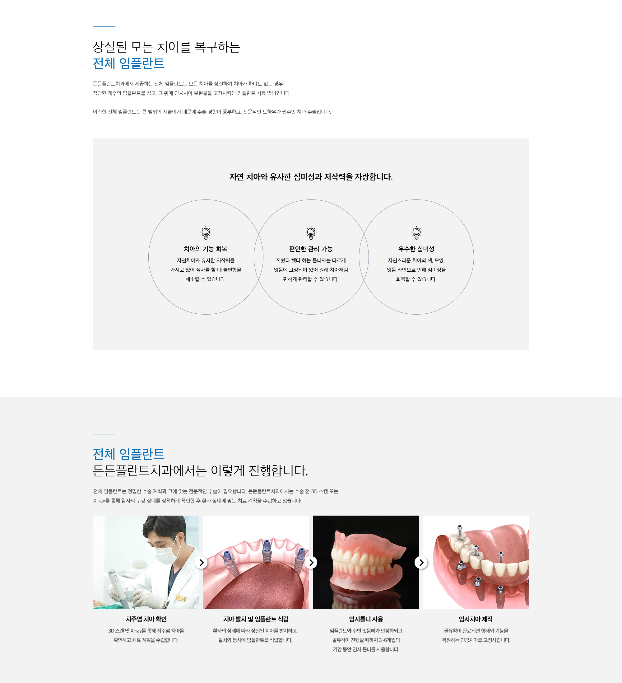 전체(무치악) 임플란트